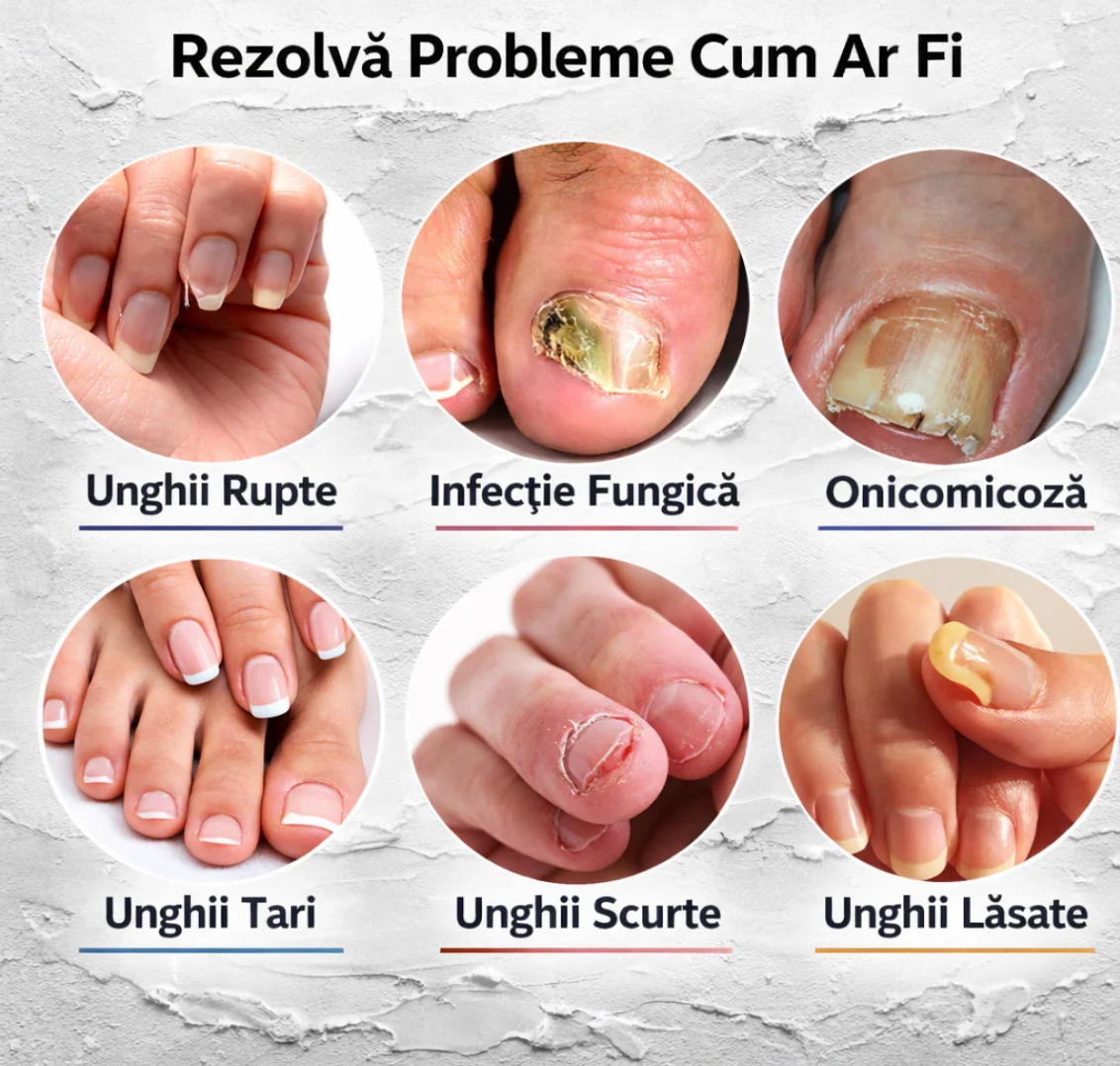 Ulei Antifungic - CleanFeet™
