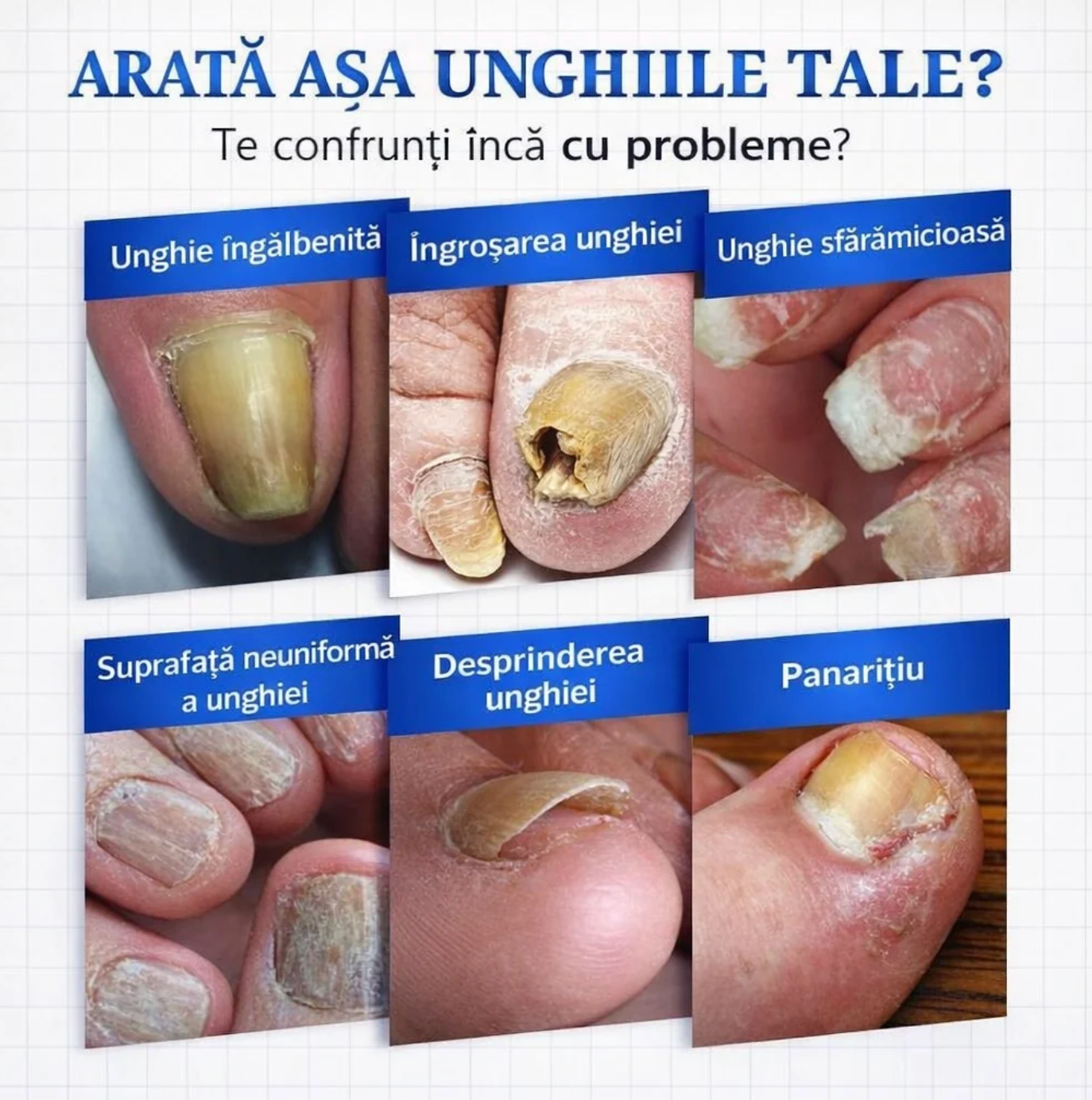 Ulei Antifungic - CleanFeet™