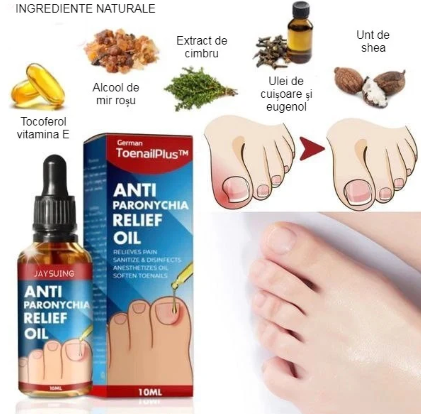 Ulei Antifungic - CleanFeet™